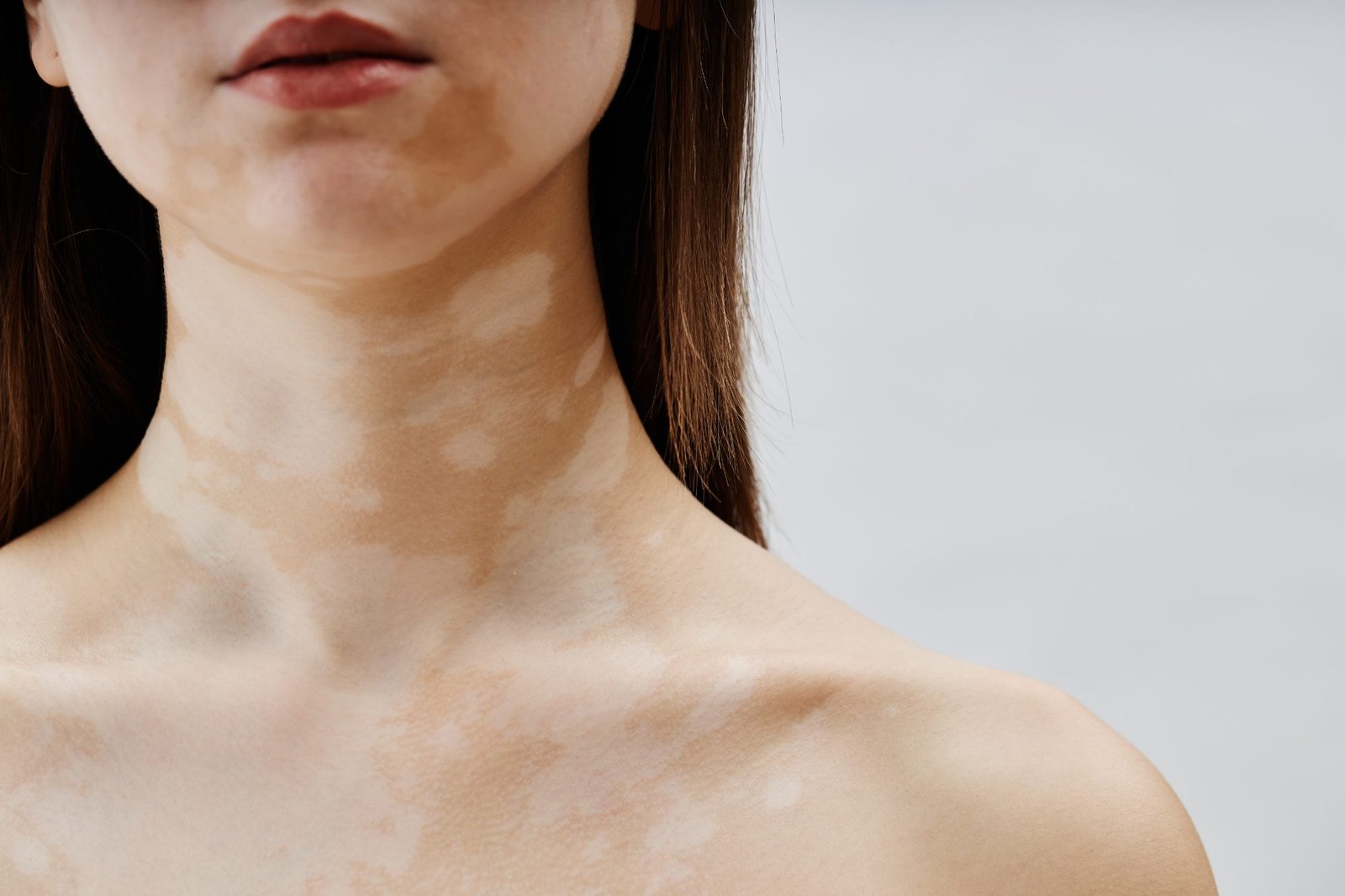 Hautbild – Dermatologie